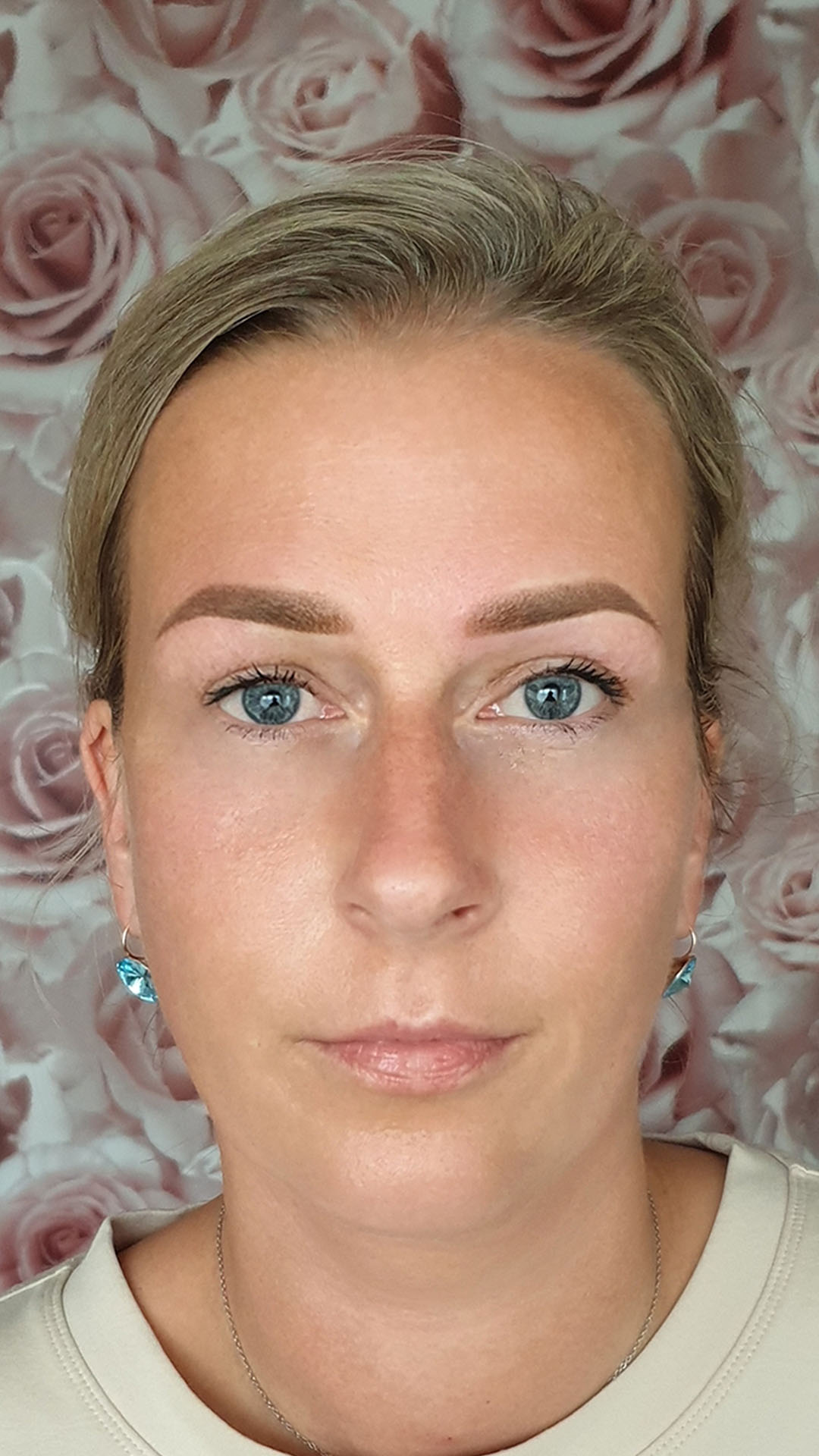 after lip transformation lady 01