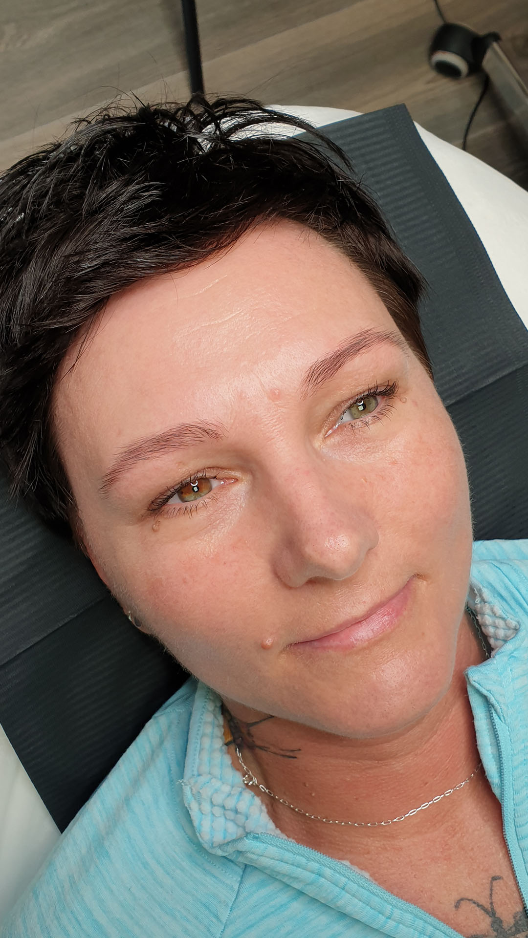 woman in a white shirt displays a prominent red mark on her face, conveying a sense of contemplation and resilience before