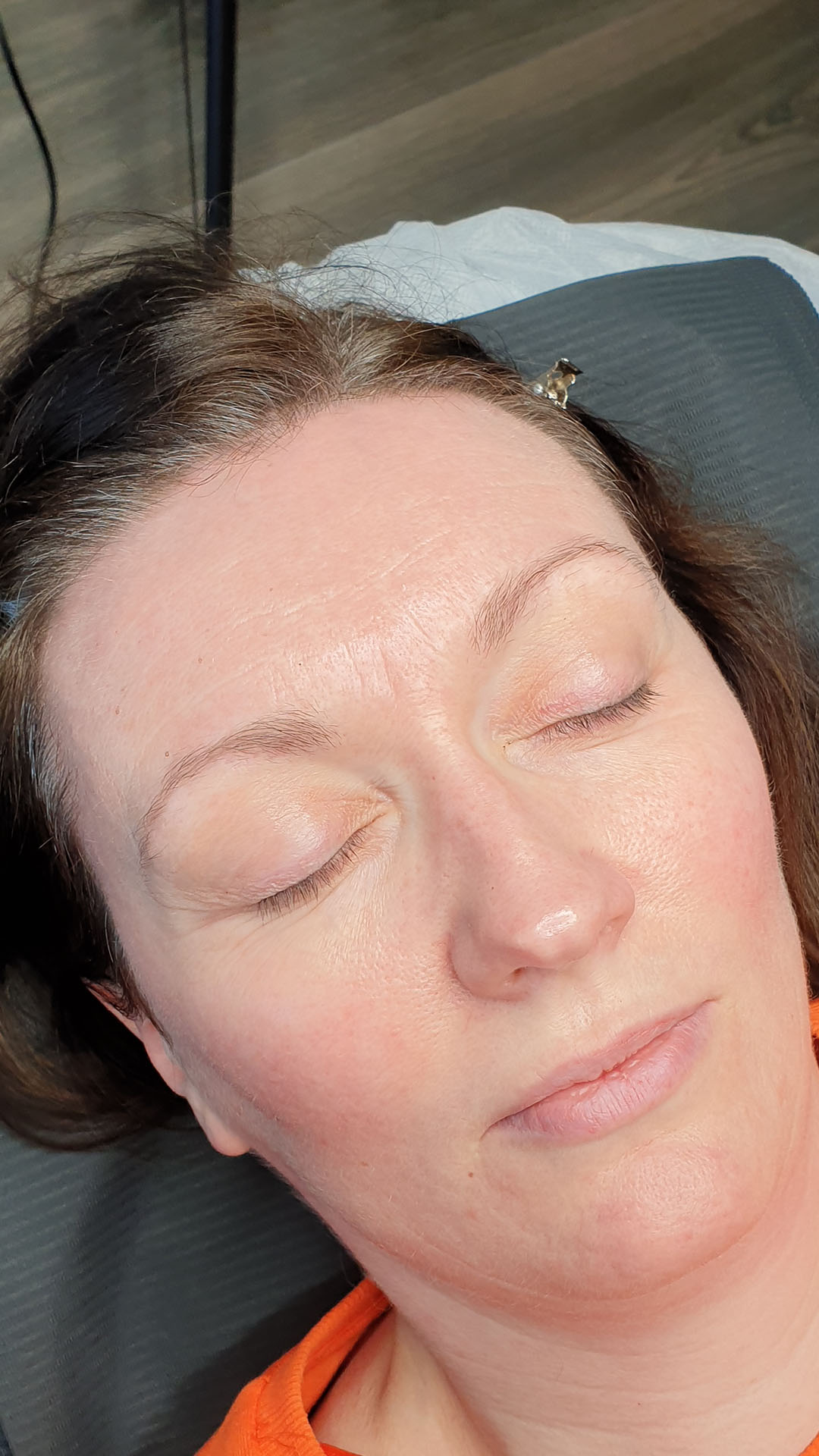 before brow transformaiton lady 02